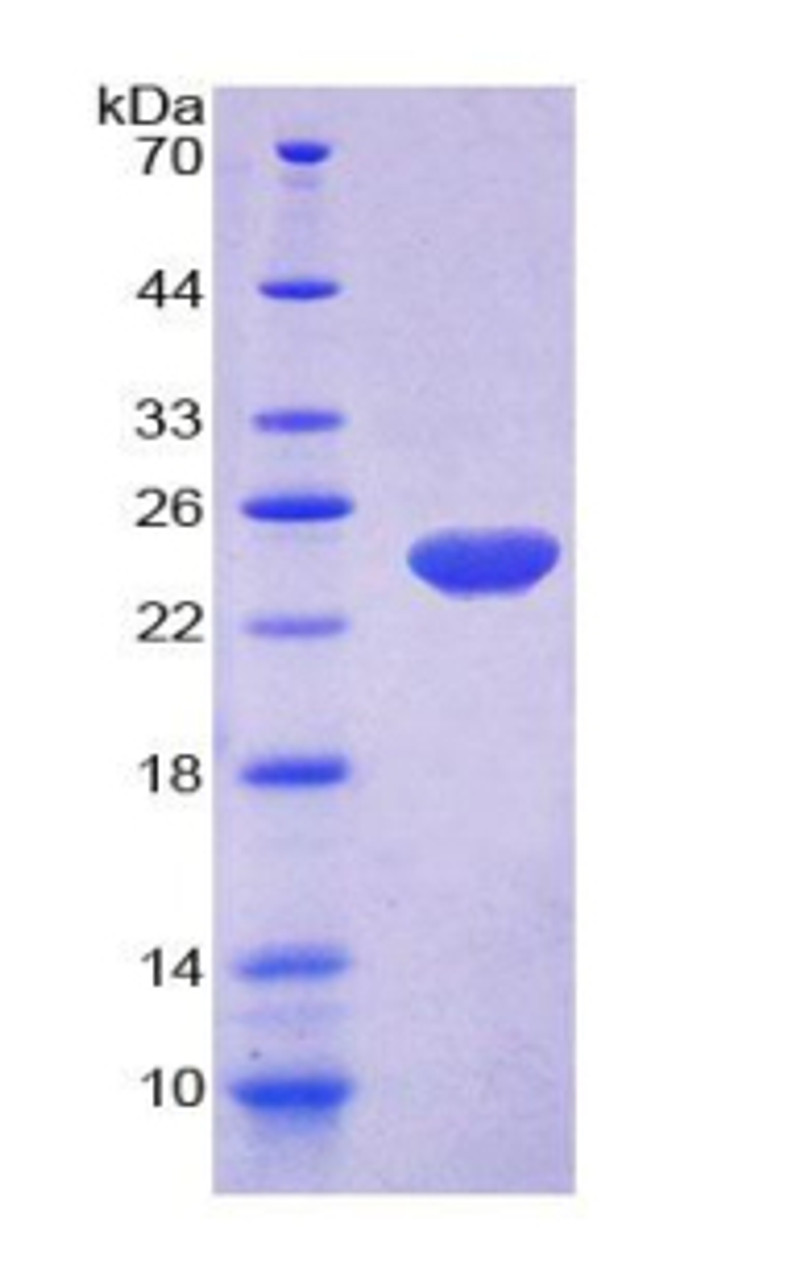 Cattle Recombinant Nitric Oxide Synthase 3, Endothelial (NOS3)