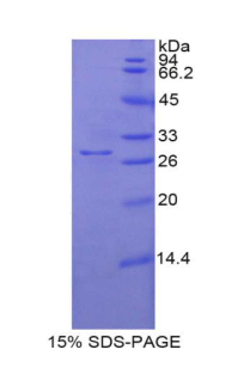 Pig Recombinant Nitric Oxide Synthase 3, Endothelial (NOS3)