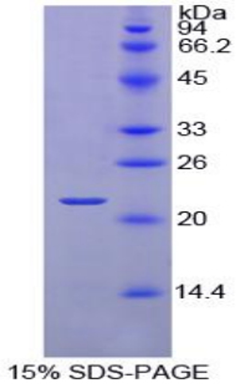 Chicken Recombinant Retinol Binding Protein 4, Plasma (RBP4)