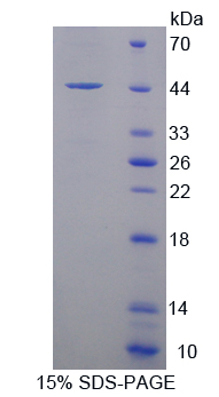 Human Recombinant Synuclein Gamma (SNCg)