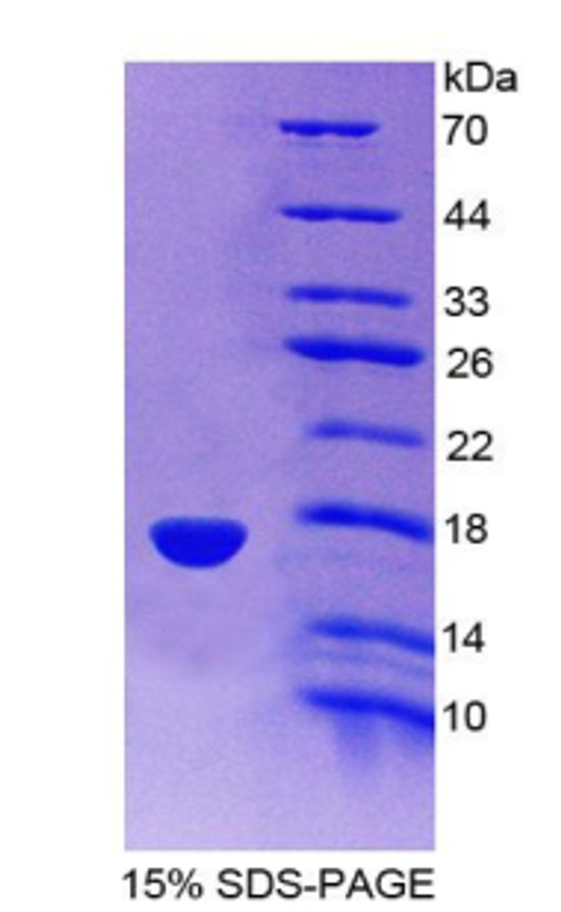 Rat Recombinant Synuclein Gamma (SNCg)