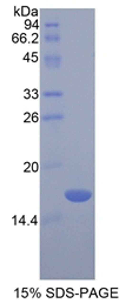 Rat Recombinant Chemerin (CHEM)