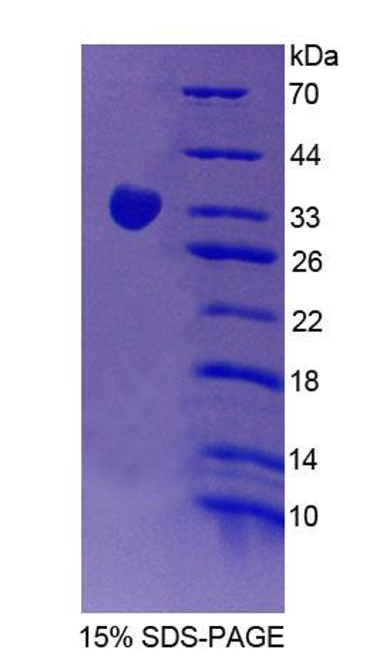 Human Recombinant Signal Regulatory Protein Gamma (SIRPg)