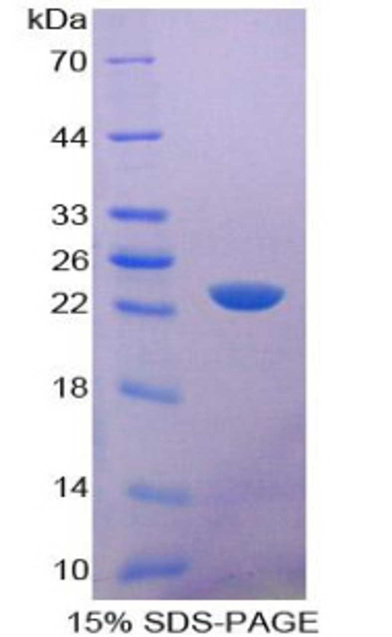 Mouse Recombinant Cluster Of Differentiation 6 (CD6)