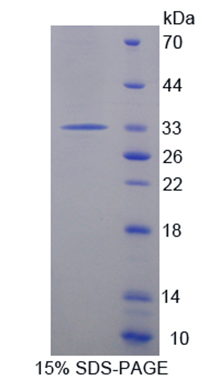 Rat Recombinant Protein Tyrosine Phosphatase Receptor Type H (PTPRH)