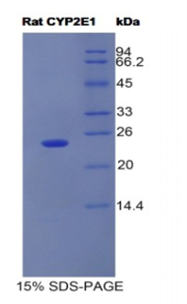 Rat Recombinant Cytochrome P450 2E1 (CYP2E1)