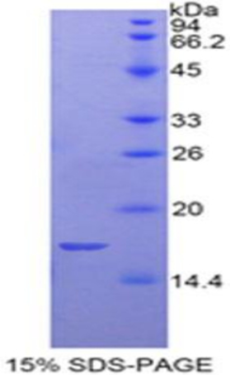 Rat Recombinant Glycoprotein Ib Beta Polypeptide, Platelet (GP1Bb)
