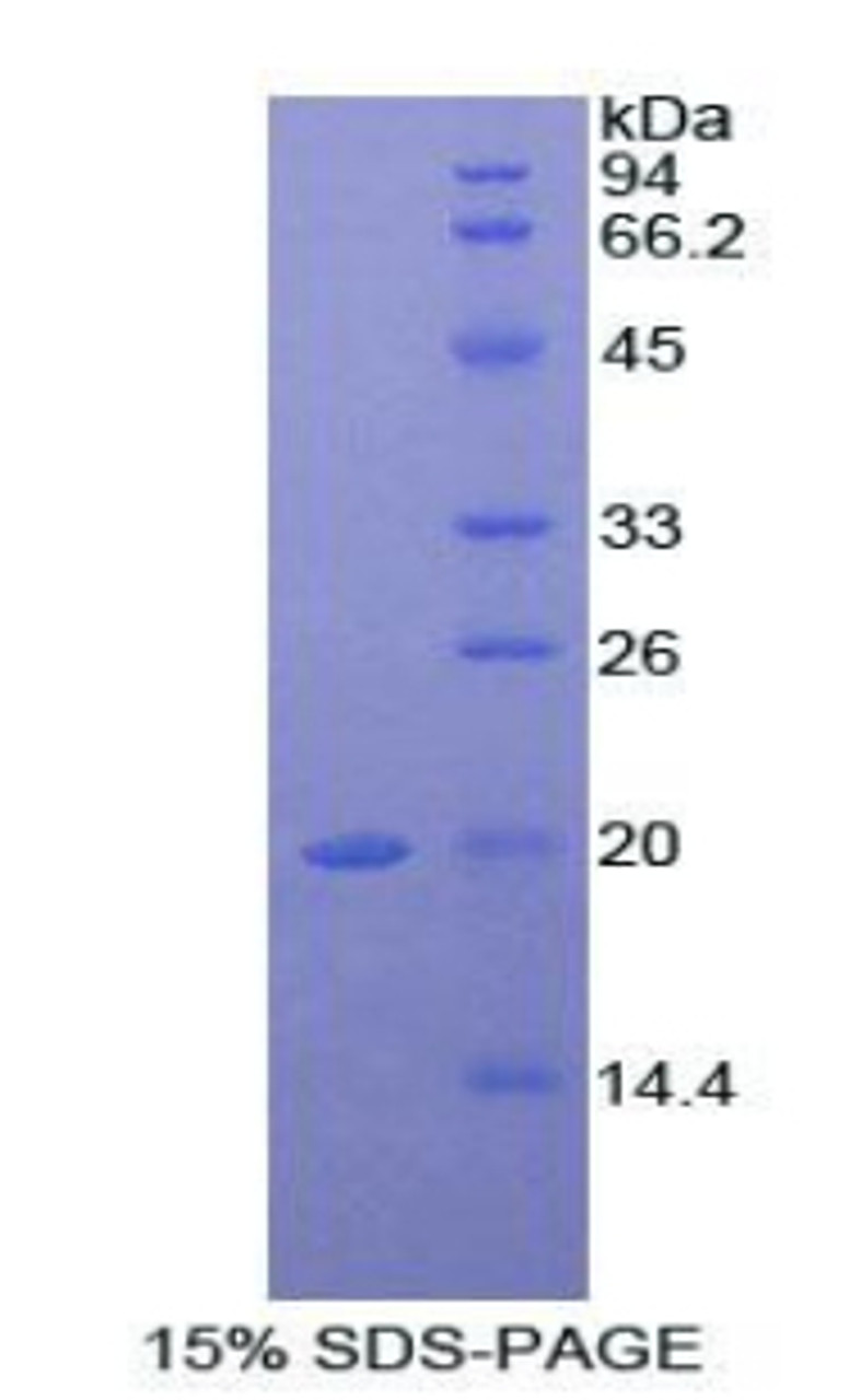 Mouse Recombinant Alpha-2-Macroglobulin (a2M)