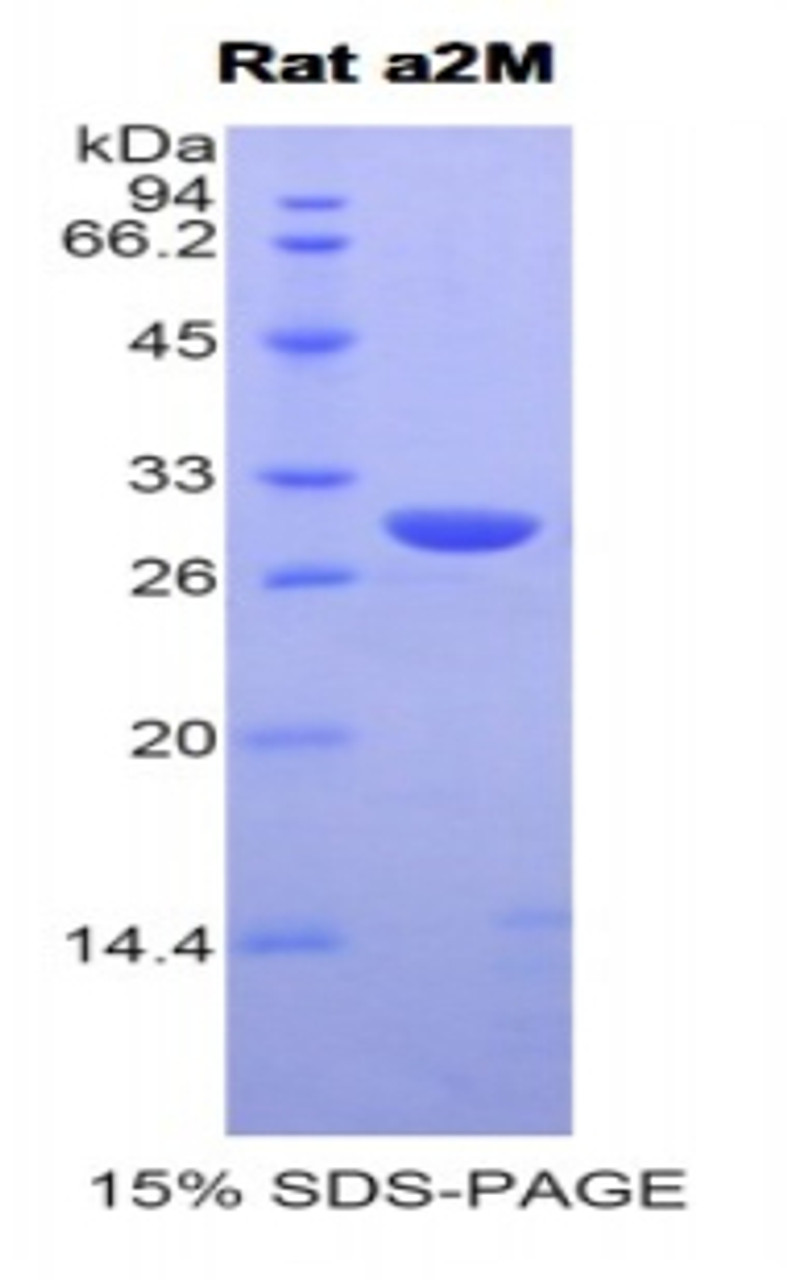 Rat Recombinant Alpha-2-Macroglobulin (a2M)