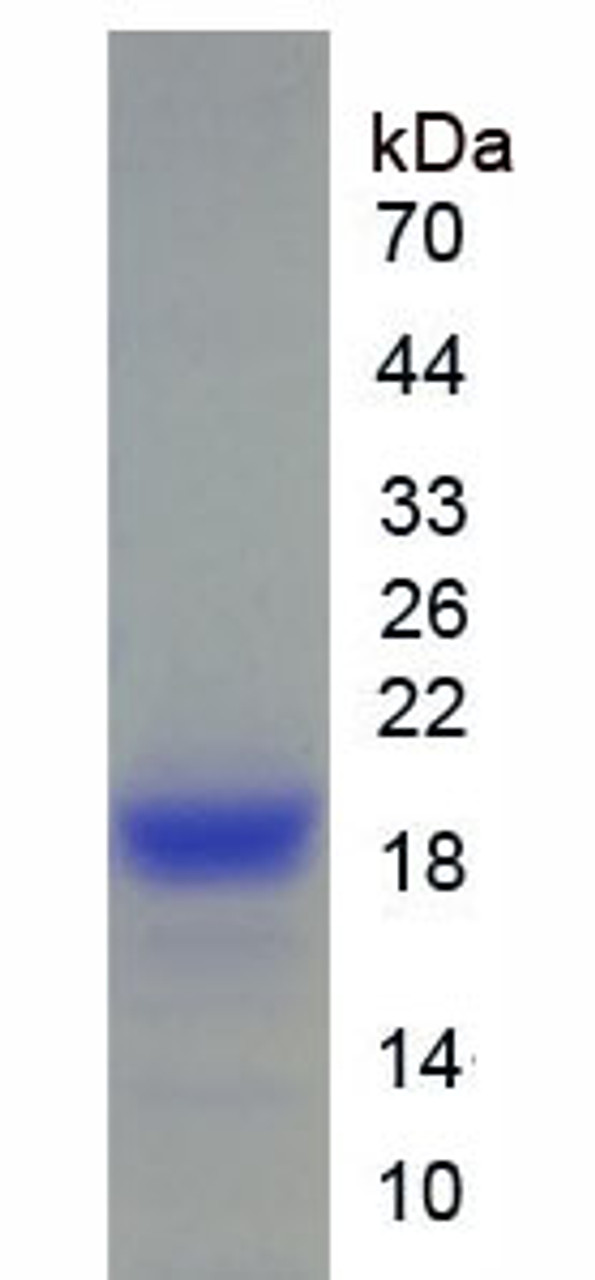 Pig Recombinant Angiopoietin Like Protein 4 (ANGPTL4)