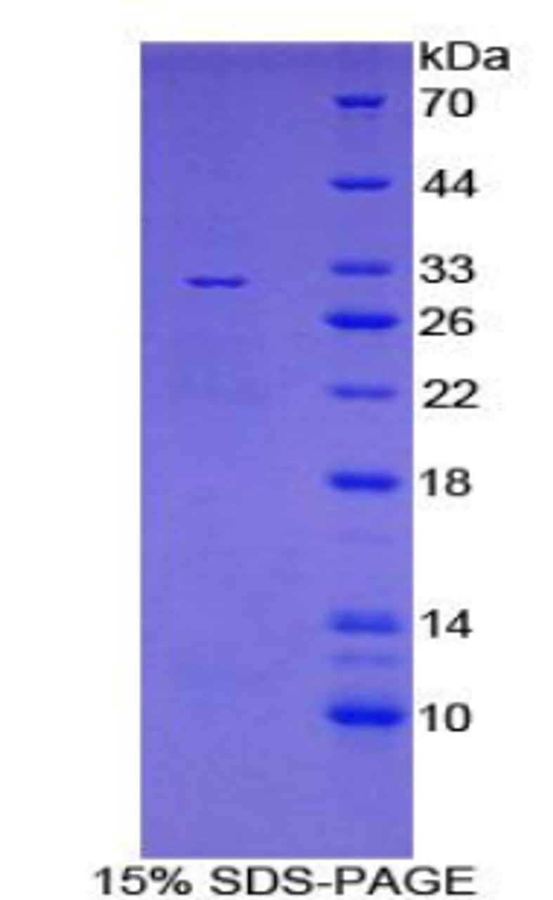 Mouse Recombinant Growth Hormone Receptor (GHR)