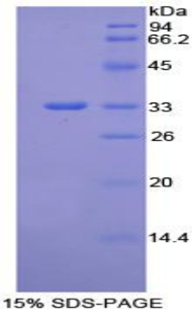 Mouse Recombinant Integrin Beta 1 (ITGb1)