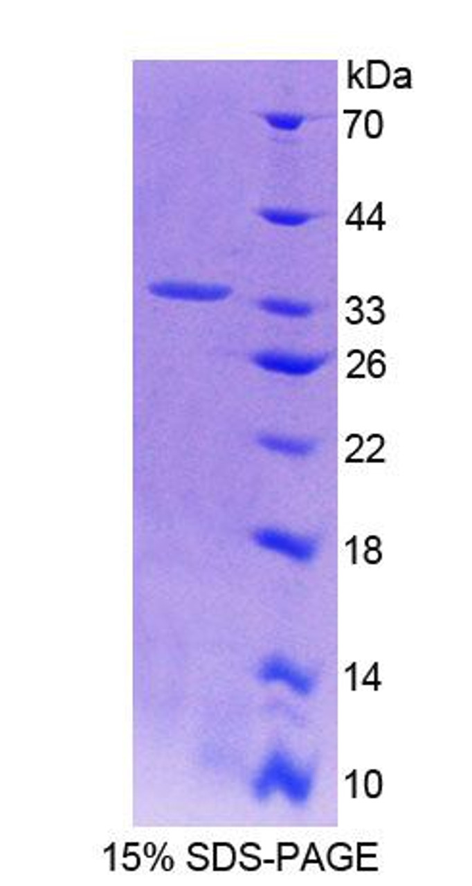 Human Recombinant Actinin Alpha 3 (ACTN3)