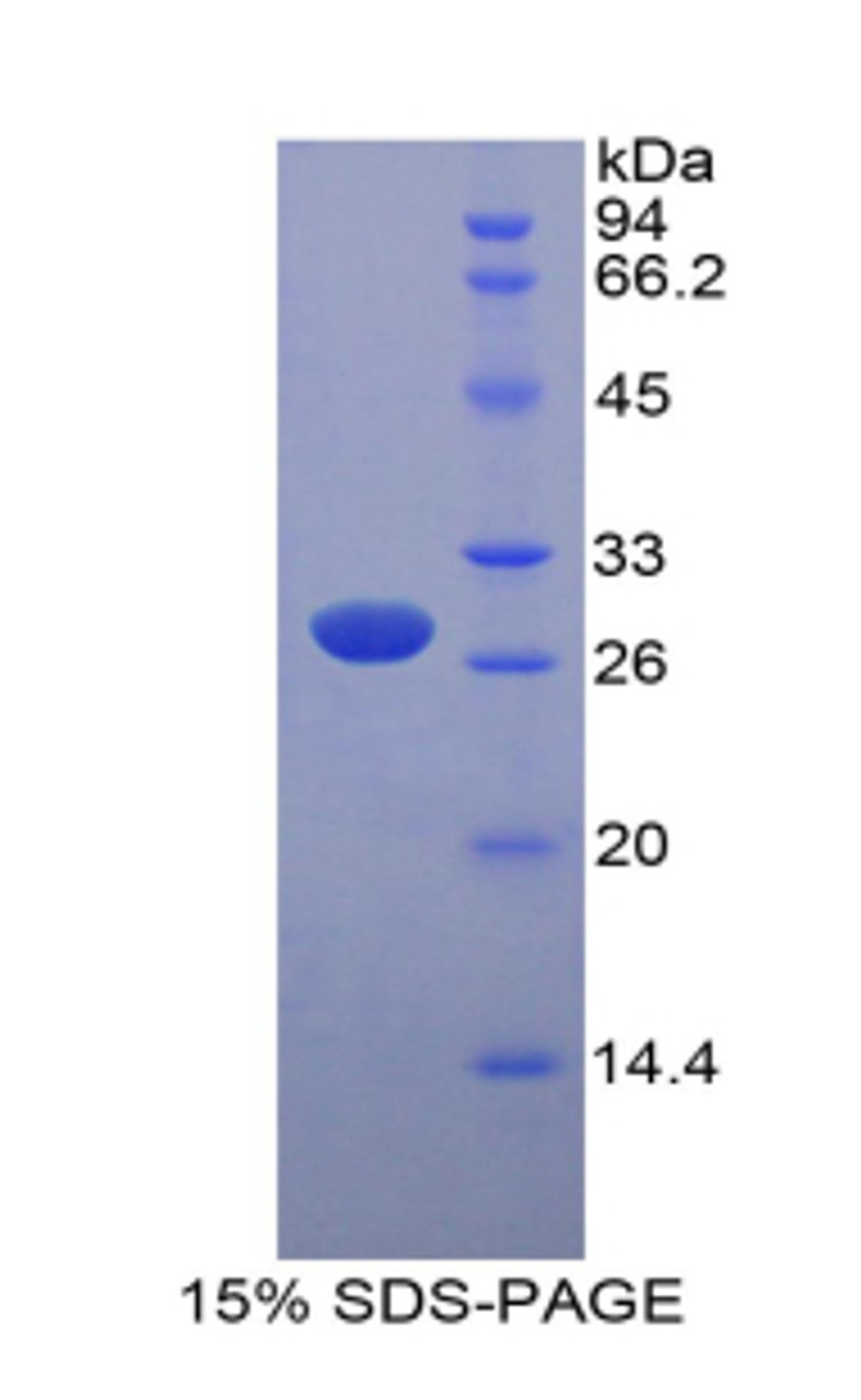 Mouse Recombinant Myosin Light Chain Kinase (MYLK)