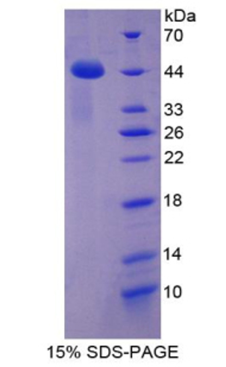 Human Recombinant Chemokine C-C-Motif Ligand 16 (CCL16)