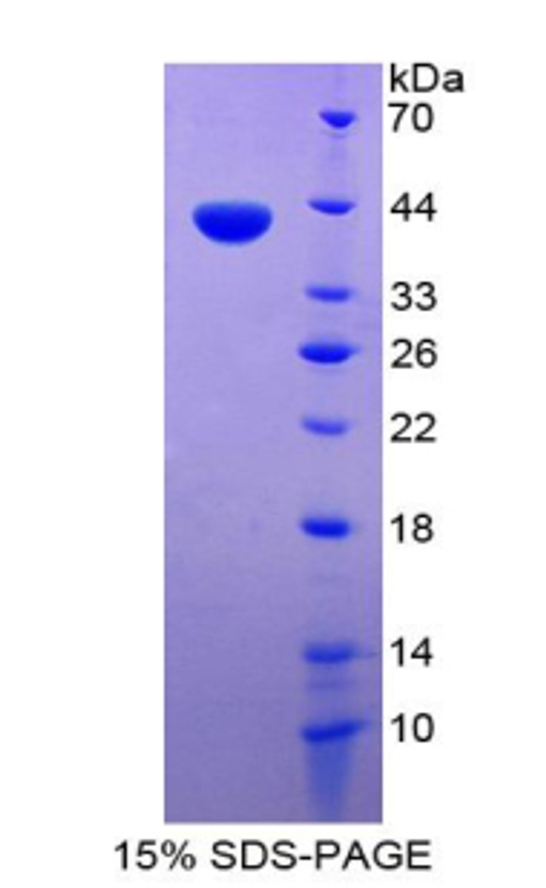 Human Recombinant Chemokine C-C-Motif Ligand 1 (CCL1)