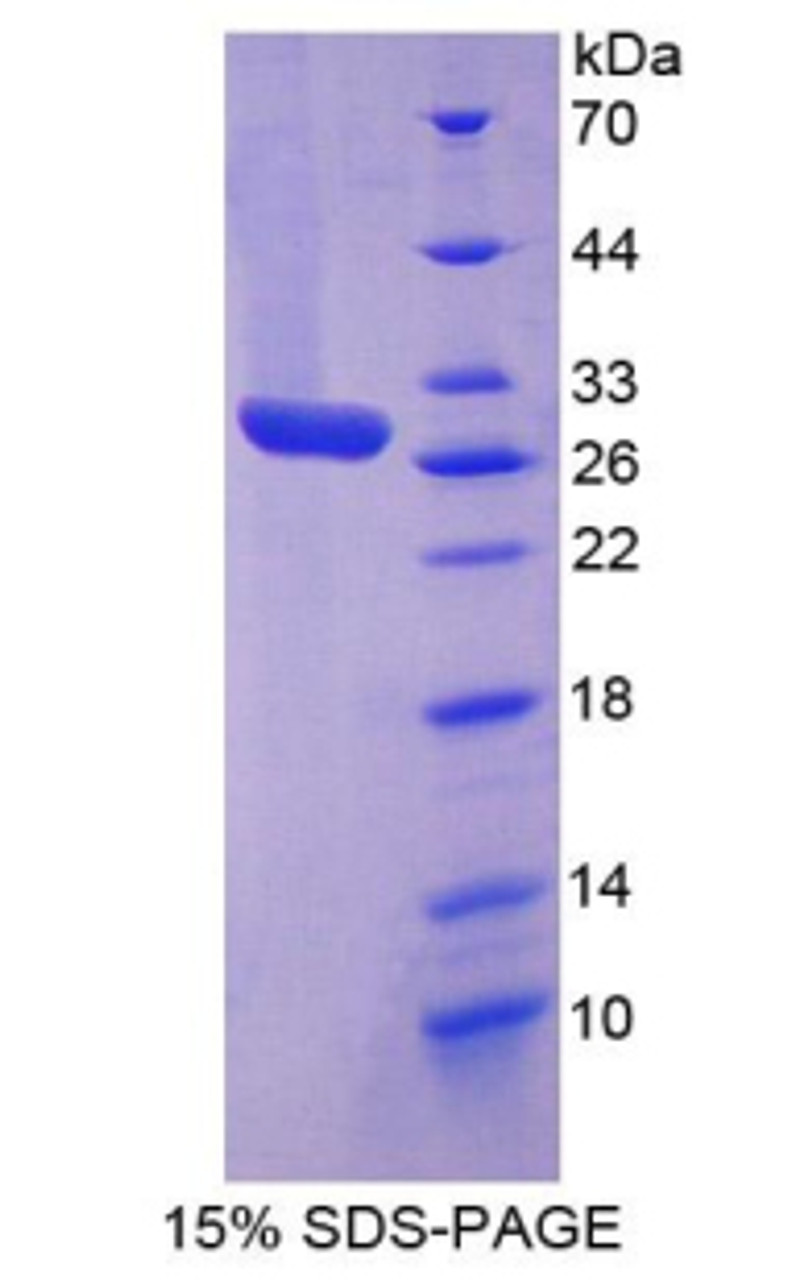 Cattle Recombinant Clusterin (CLU)