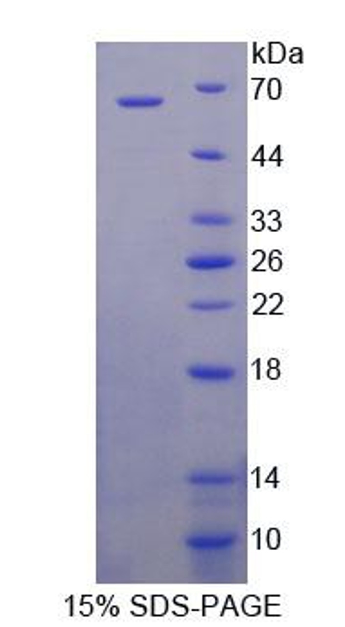 Mouse Recombinant Taxilin Alpha (TXLNa)