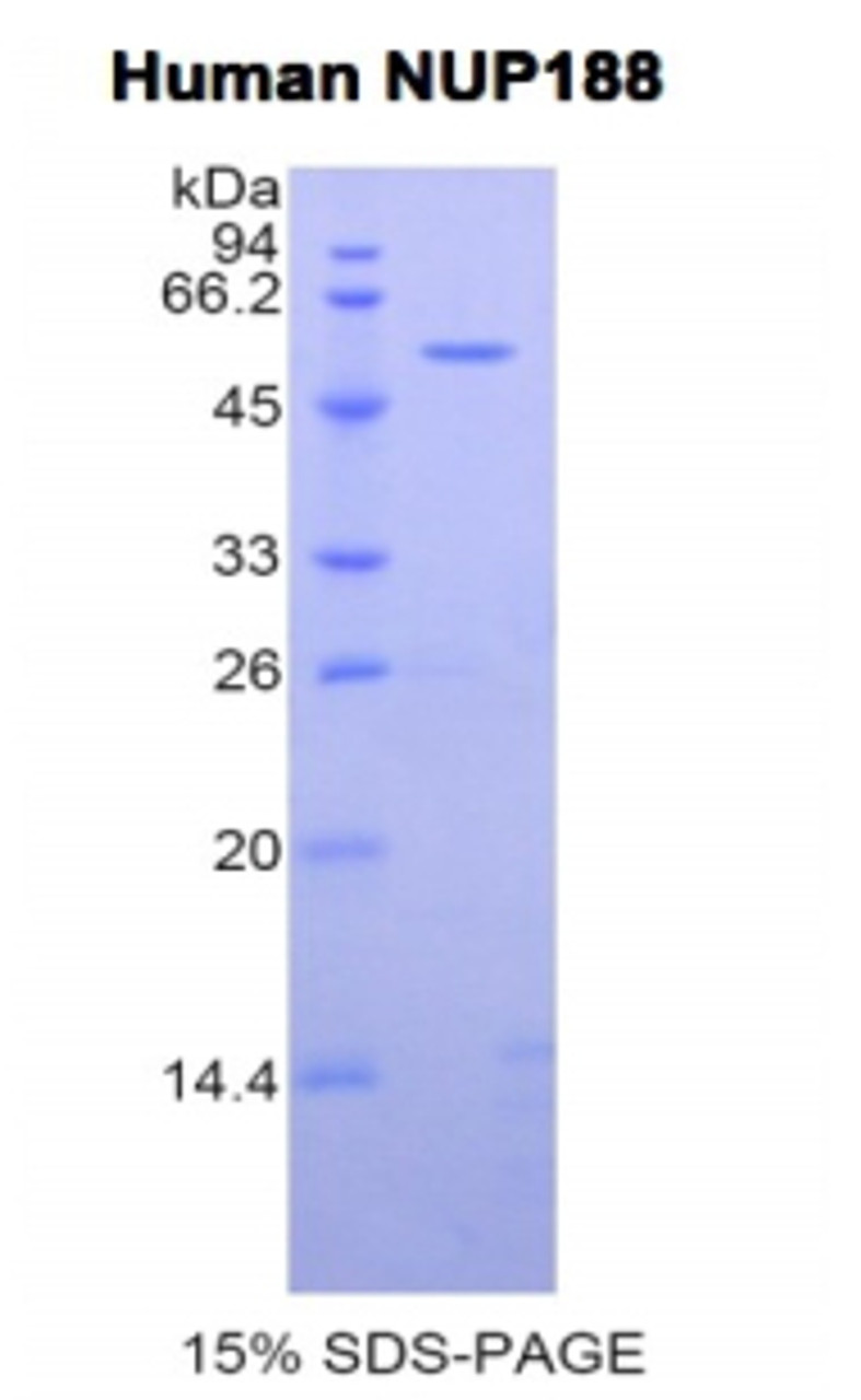 Human Recombinant Nucleoporin 188kDa (NUP188)