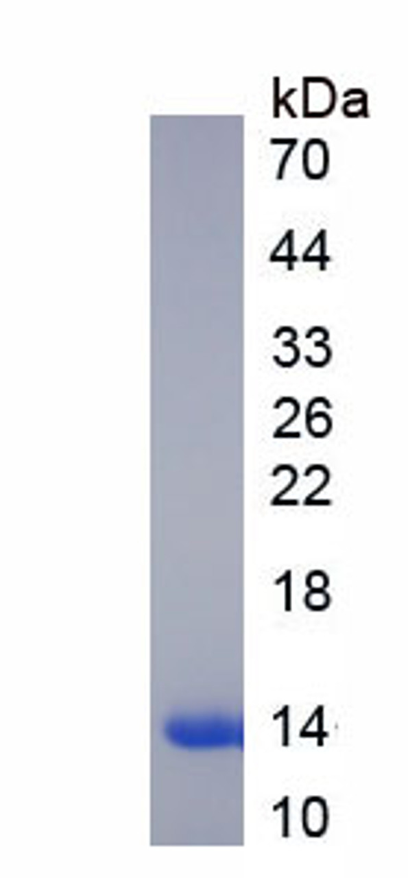 Human Recombinant Lysozyme (LZM)