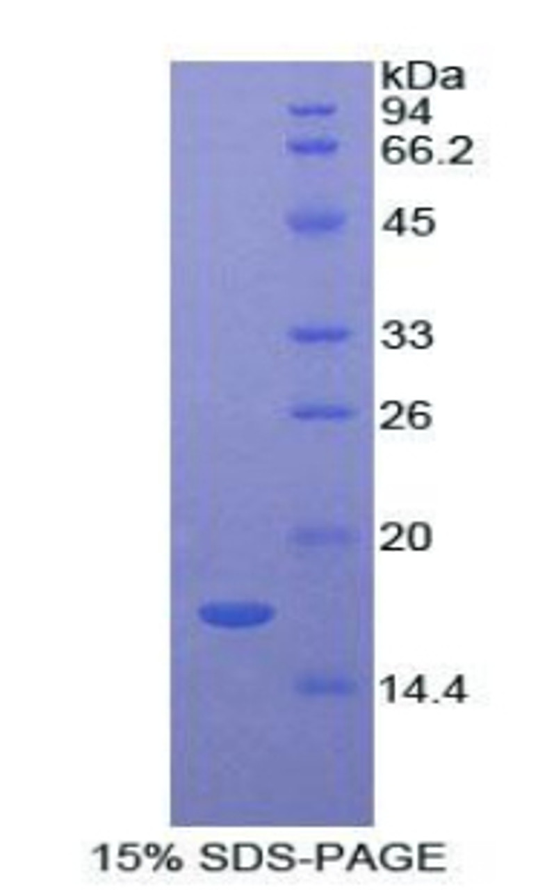 Rat Recombinant Lysozyme (LZM)