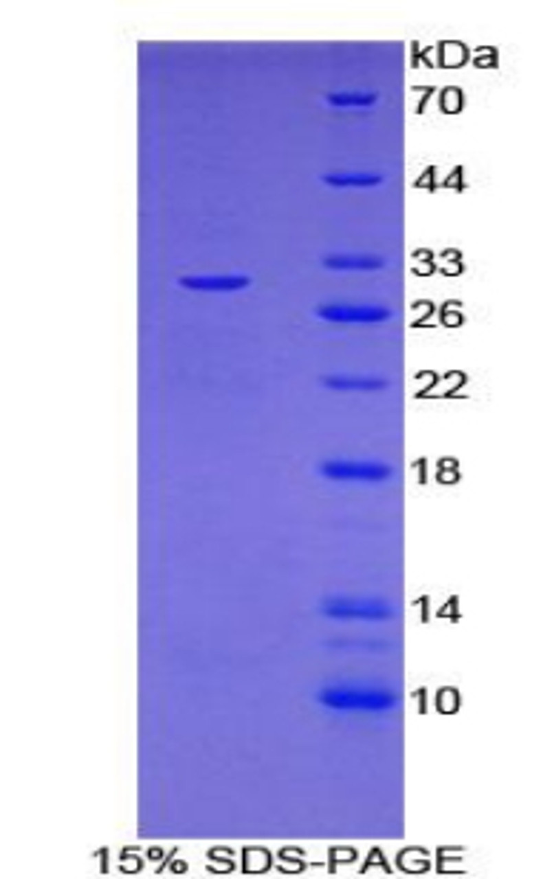 Mouse Recombinant Interleukin 27 Receptor Alpha (IL27Ra)