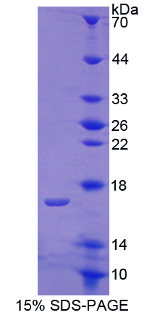 Human Recombinant Cartilage Oligomeric Matrix Protein (COMP)