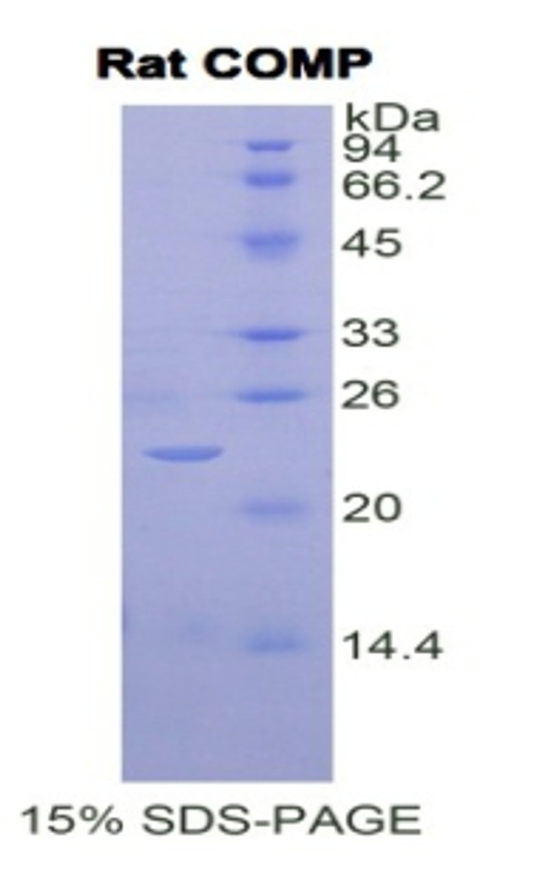 Rat Recombinant Cartilage Oligomeric Matrix Protein (COMP)