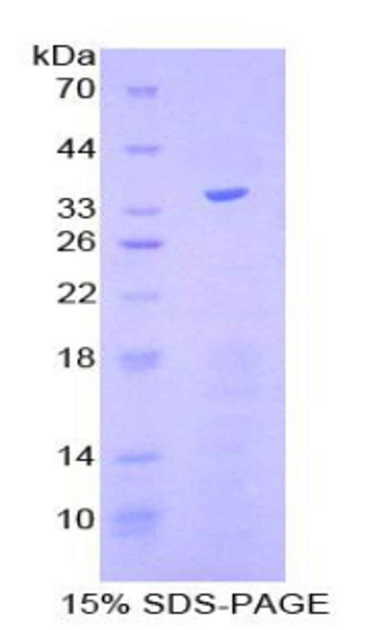 Human Recombinant Kruppel Like Factor 4, Gut (KLF4)