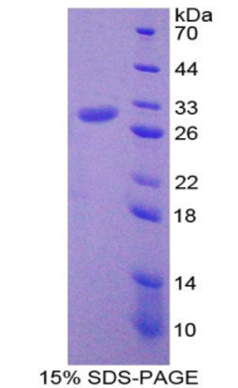 Mouse Recombinant Programmed Cell Death Protein 6 Interacting Protein (PDCD6IP)