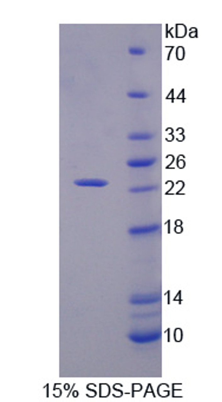 Mouse Recombinant Tumor Necrosis Factor Receptor Superfamily, Member 5 (TNFRSF5)