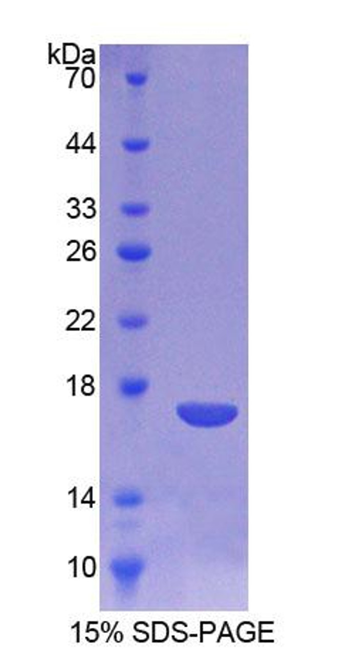 Human Recombinant Cathepsin D (CTSD)