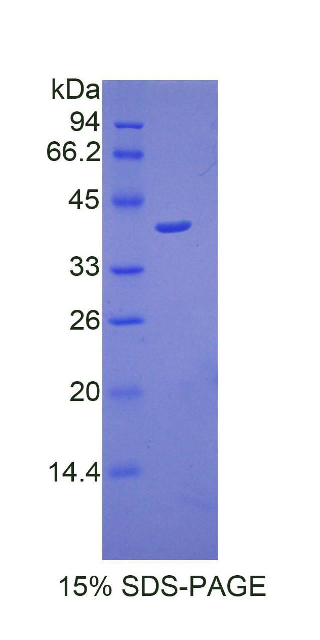Mouse Recombinant Cathepsin D (CTSD)