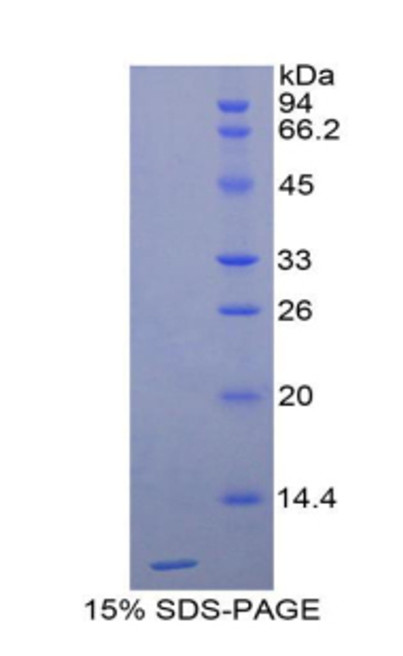 Rat Recombinant Cathepsin D (CTSD)