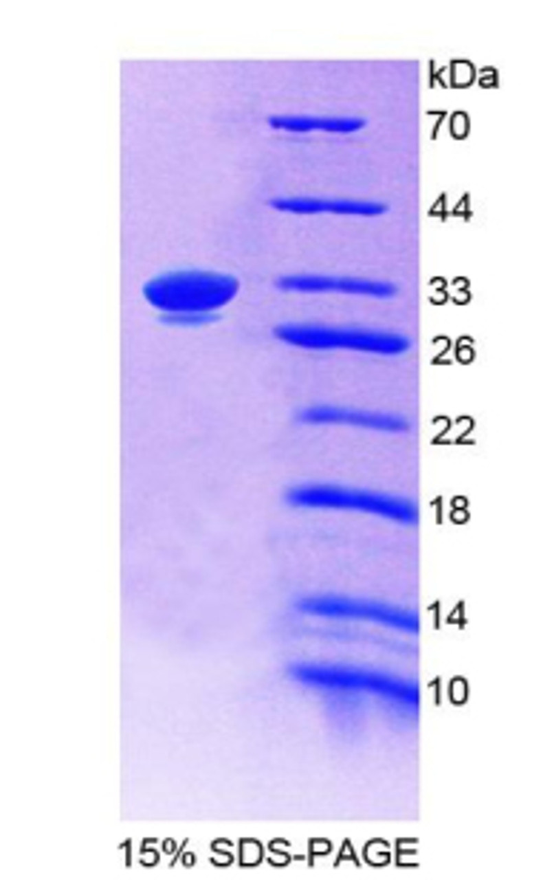 Pig Recombinant Epithelial Cell Adhesion Molecule (EPCAM)