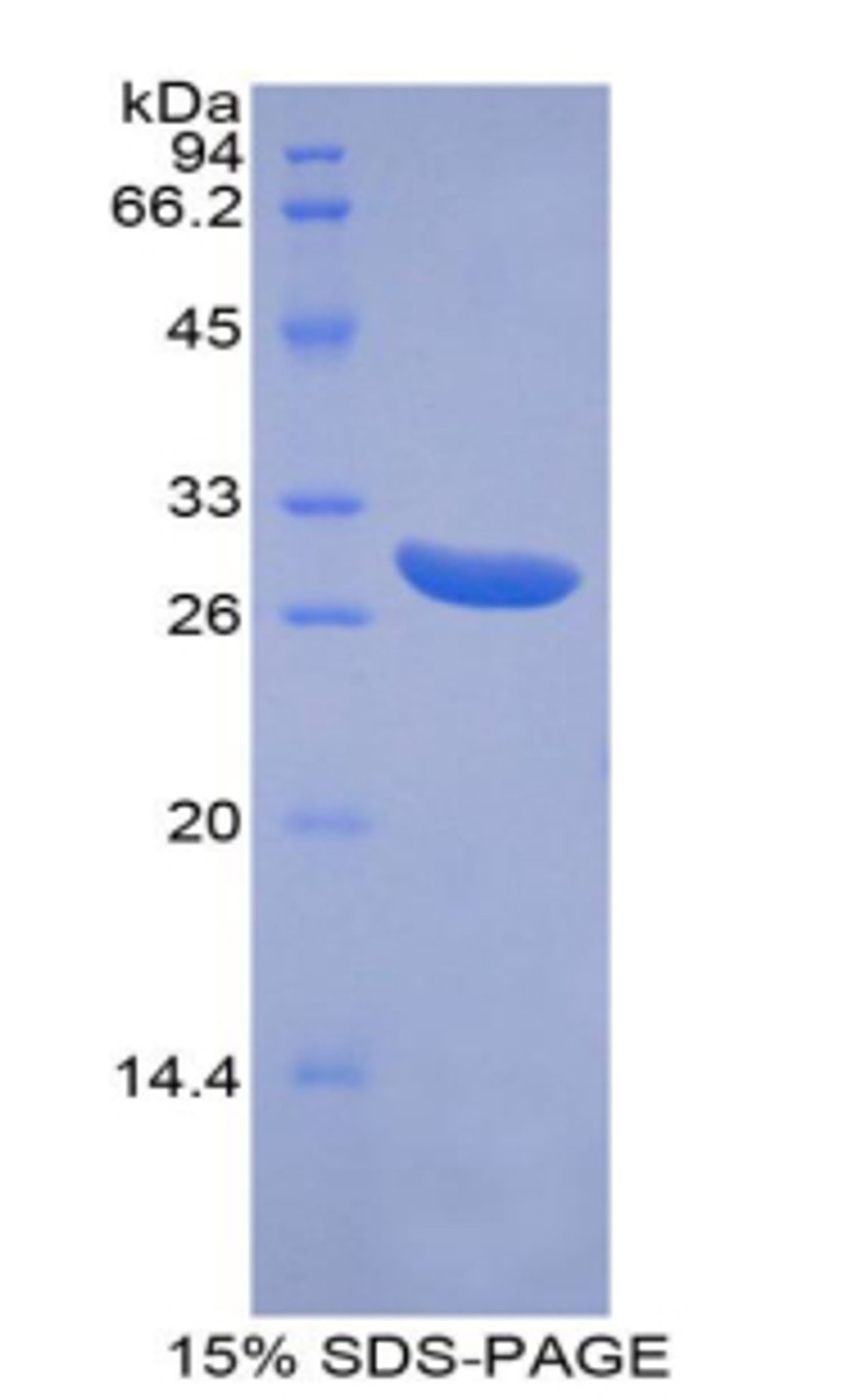 Human Recombinant ATP Binding Cassette Transporter G1 (ABCG1)