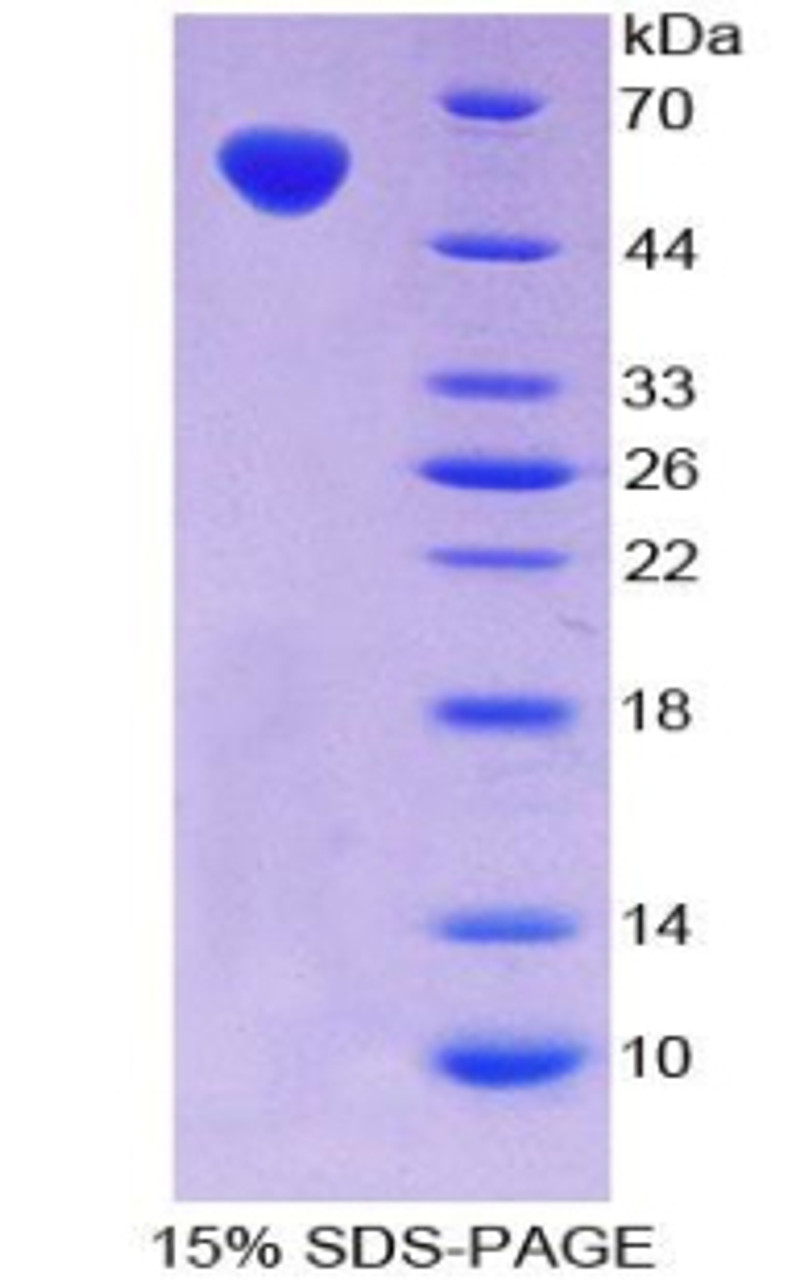 Mouse Recombinant V-Fos FBJ Murine Osteosarcoma Viral Oncogene Homolog (FOS)