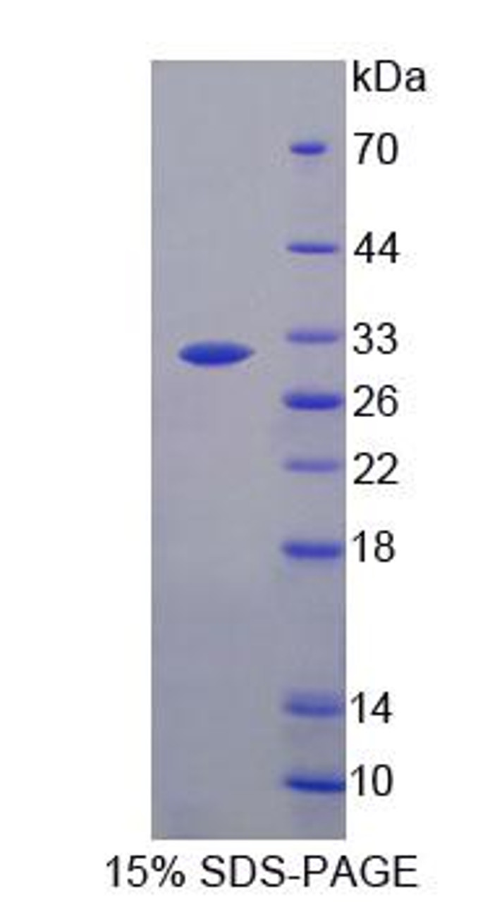 Human Recombinant Agrin (AGRN)