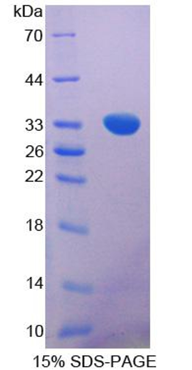 Mouse Recombinant Proopiomelanocortin (POMC)