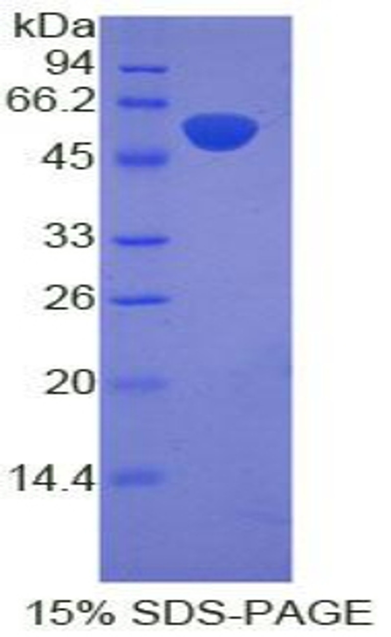 Rat Recombinant Proopiomelanocortin (POMC)