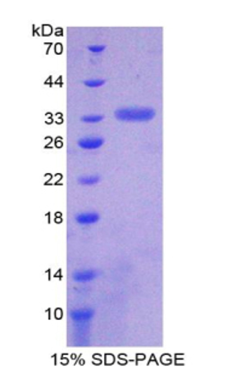 Chicken Recombinant Integrin Alpha 1 (ITGa1)