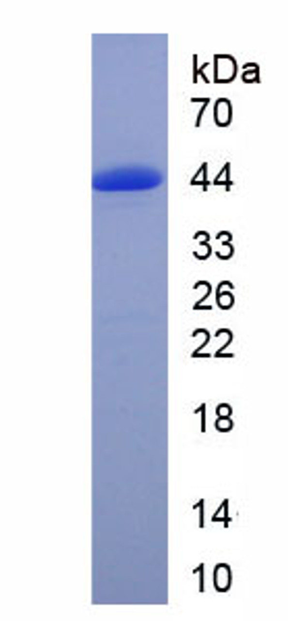 Human Recombinant Growth Associated Protein 43 (GAP43)