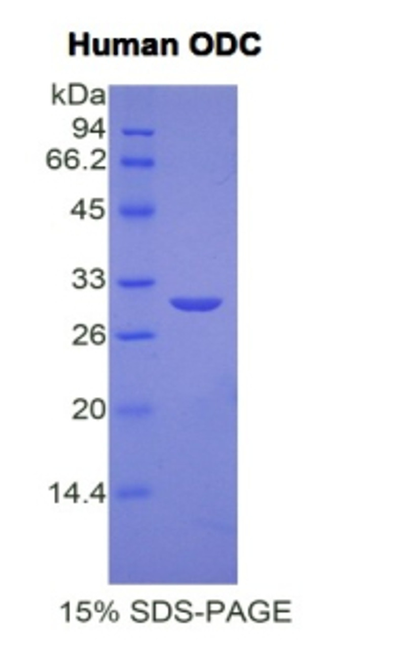 Human Recombinant Ornithine Decarboxylase (ODC)