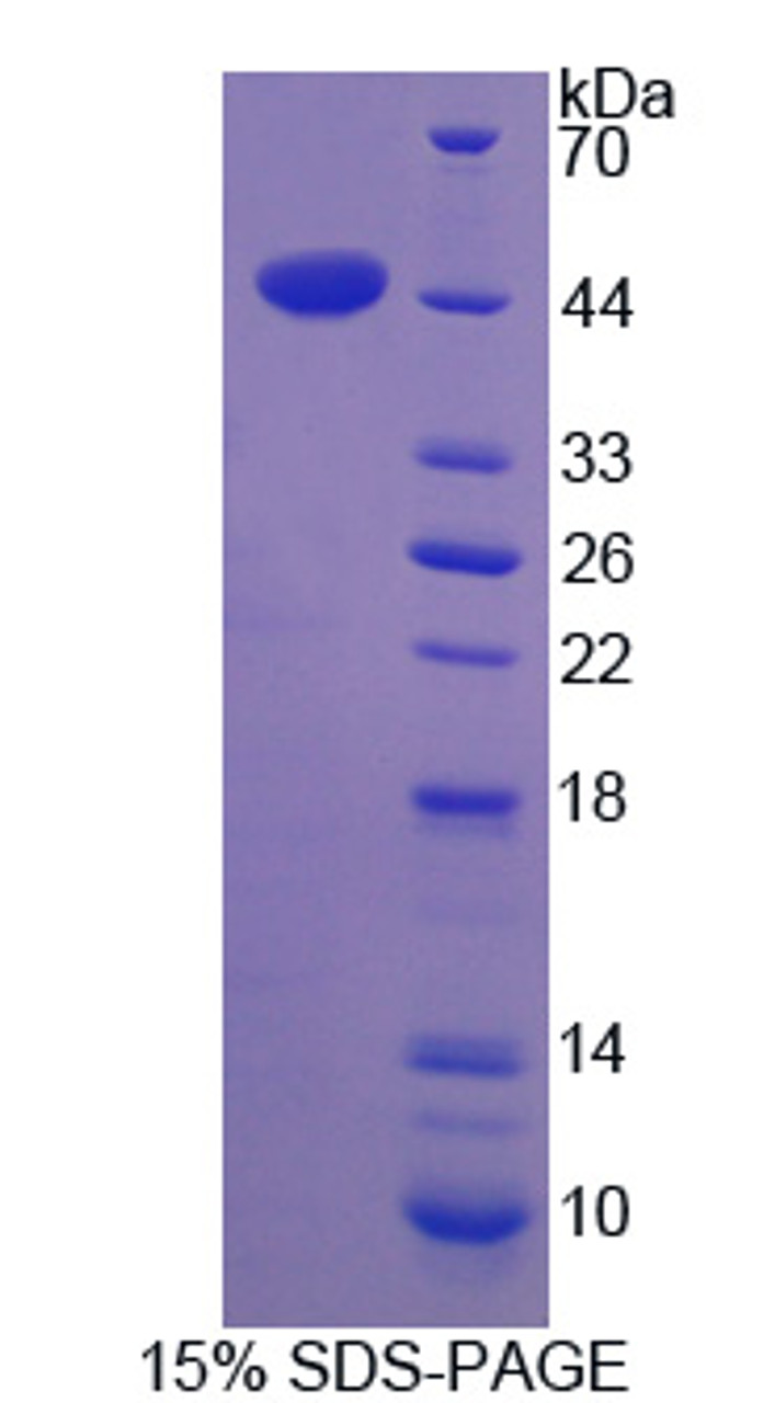 Human Recombinant Actin Gamma 2, Smooth Muscle (ACTg2)