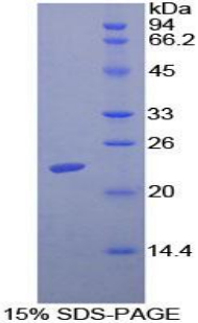 Mouse Recombinant Adenylate Cyclase Activating Polypeptide 1, Pituitary (ADCYAP1)