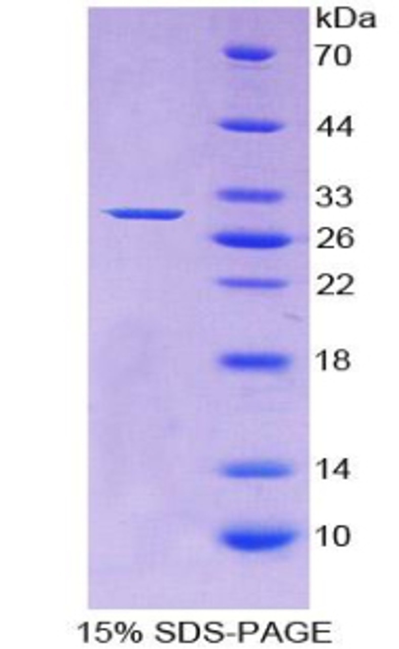 Human Recombinant Adenylate Cyclase 1, Brain (ADCY1)