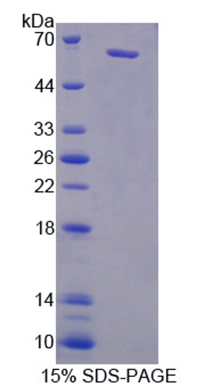 Pig Recombinant Vascular Endothelial Growth Factor Receptor 2 (VEGFR2)