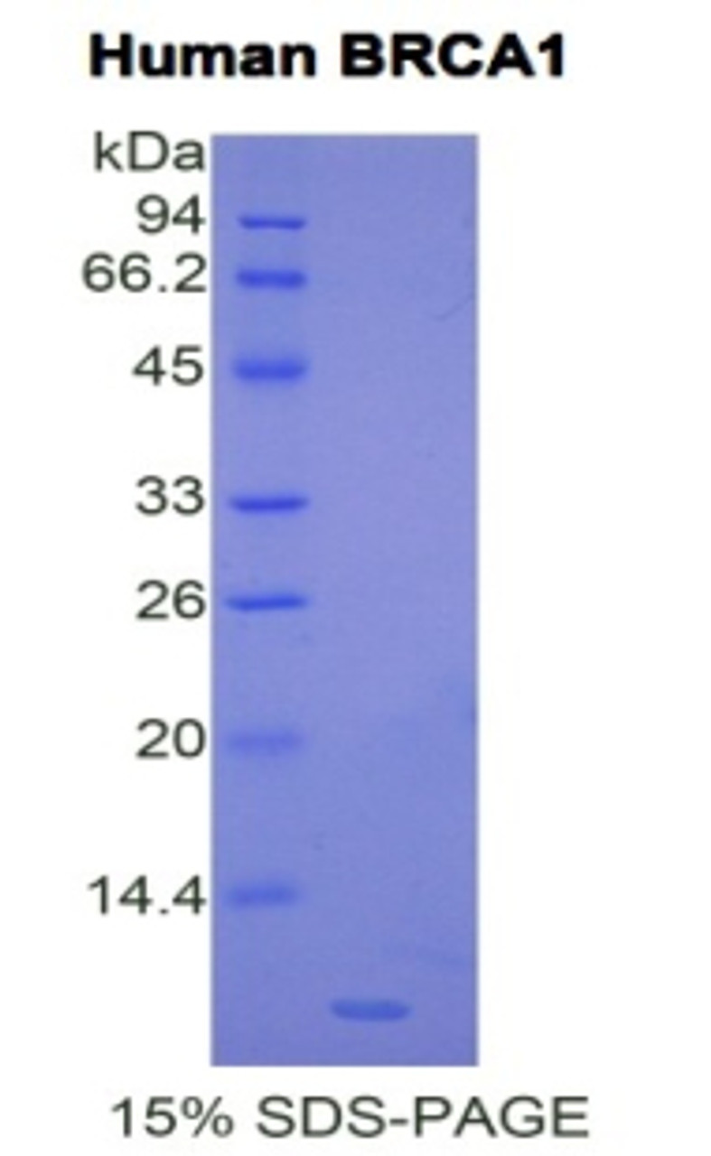 Human Recombinant Breast Cancer Susceptibility Protein 1 (BRCA1)