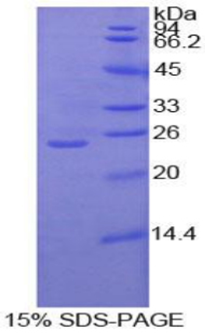 Human Recombinant Protein Kinase C Zeta (PKCz)