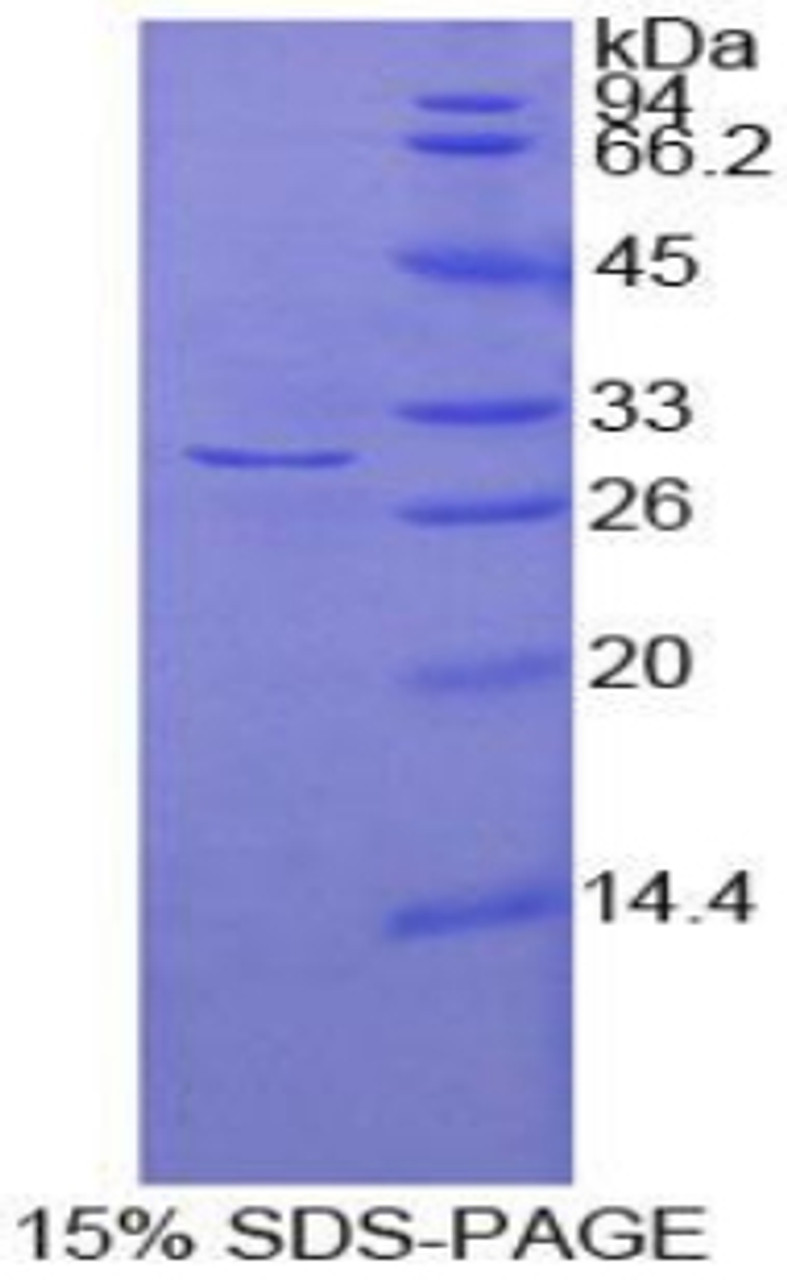 Human Recombinant Adenylate Cyclase 2, Brain (ADCY2)